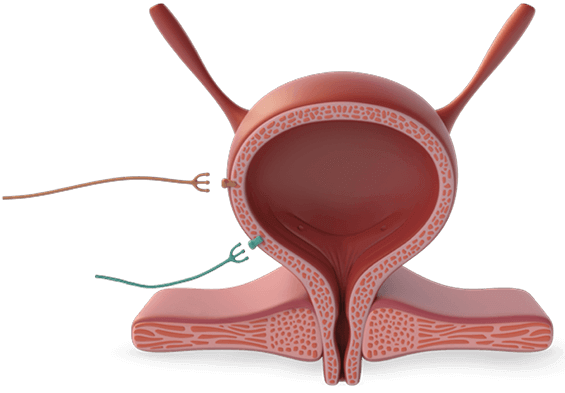 Diagram of a bladder. GEMTESA® activates the beta-3 adrenergic receptor, relaxing the bladder detrusor muscle.